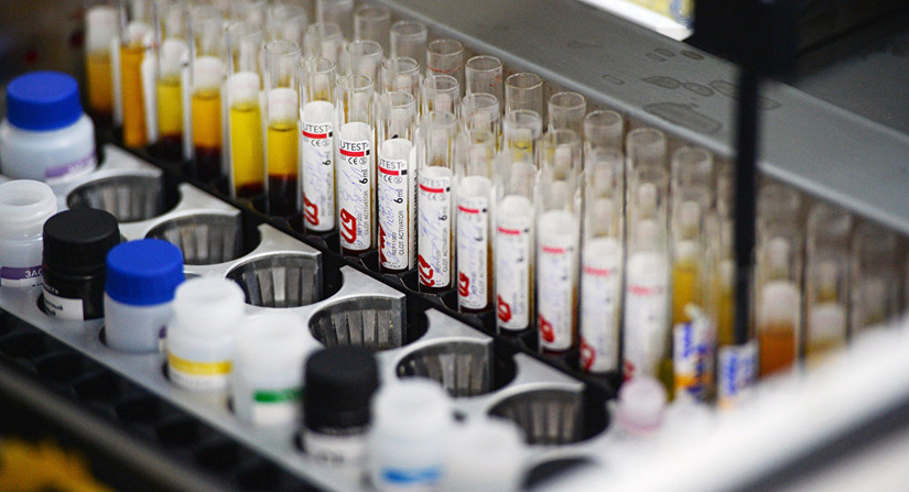 Узбекистан принимает меры для защиты от коронавируса Узбекистан принимает меры для защиты от коронавируса