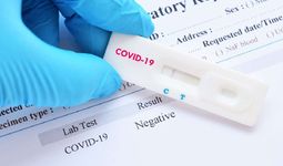 Koronavirusga test oladigan nodavlat tibbiy muassasalari ro‘yxati ma’lum qilindi