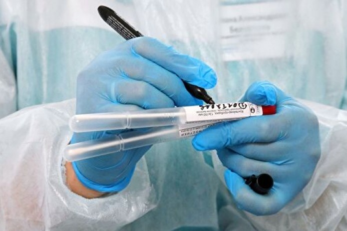 Ўзбекистонда коронавирус инфекцияси қайд этилганлар сони 2568 нафарга етди Ўзбекистонда коронавирус инфекцияси қайд этилганлар сони 2568 нафарга етди