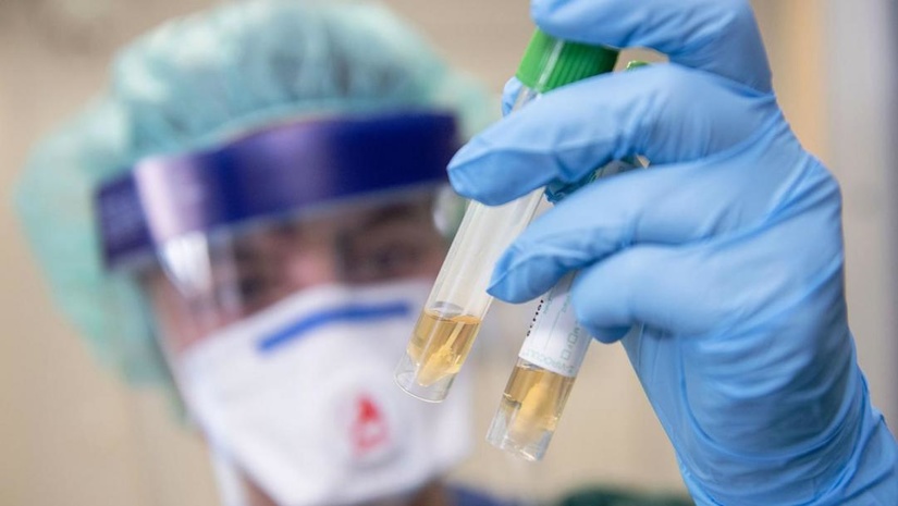 Koronavirus aniqlangan shaxslar bilan yaqin muloqotda bo‘lganlar izolyatorga joylashtiriladi Koronavirus aniqlangan shaxslar bilan yaqin muloqotda bo‘lganlar izolyatorga joylashtiriladi