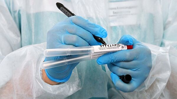 Toshkent shahrida aholi orasidan 7 kishi koronavirus yuqtirib oldi