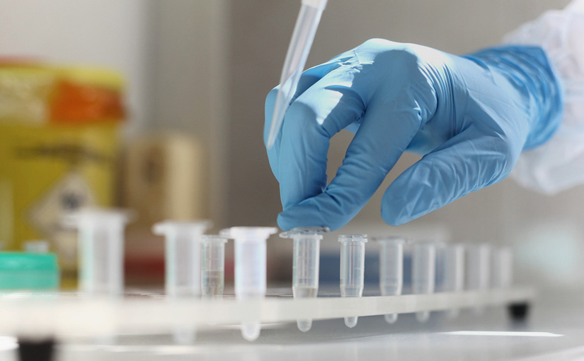 Количество выявленных случаев COVID-19 в Узбекистане достигло 10 Количество выявленных случаев COVID-19 в Узбекистане достигло 10